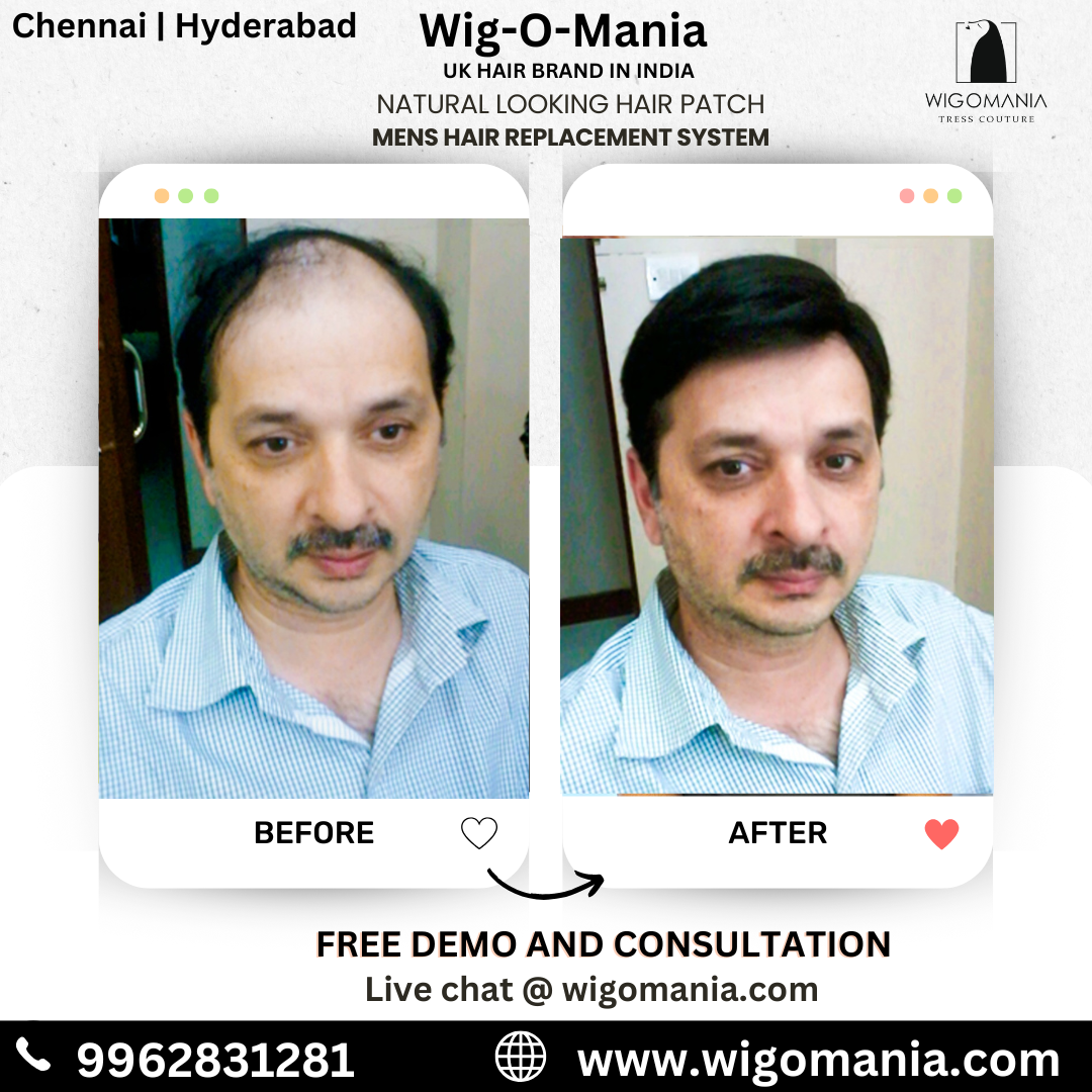 Hair patch for men
