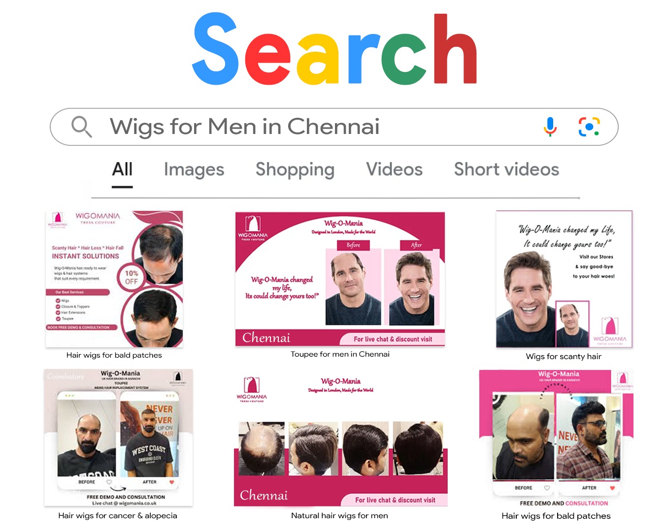 Toupee For Men in Chennai & Hyderabad | Hair Patch for Men in Chennai & Hyderabad