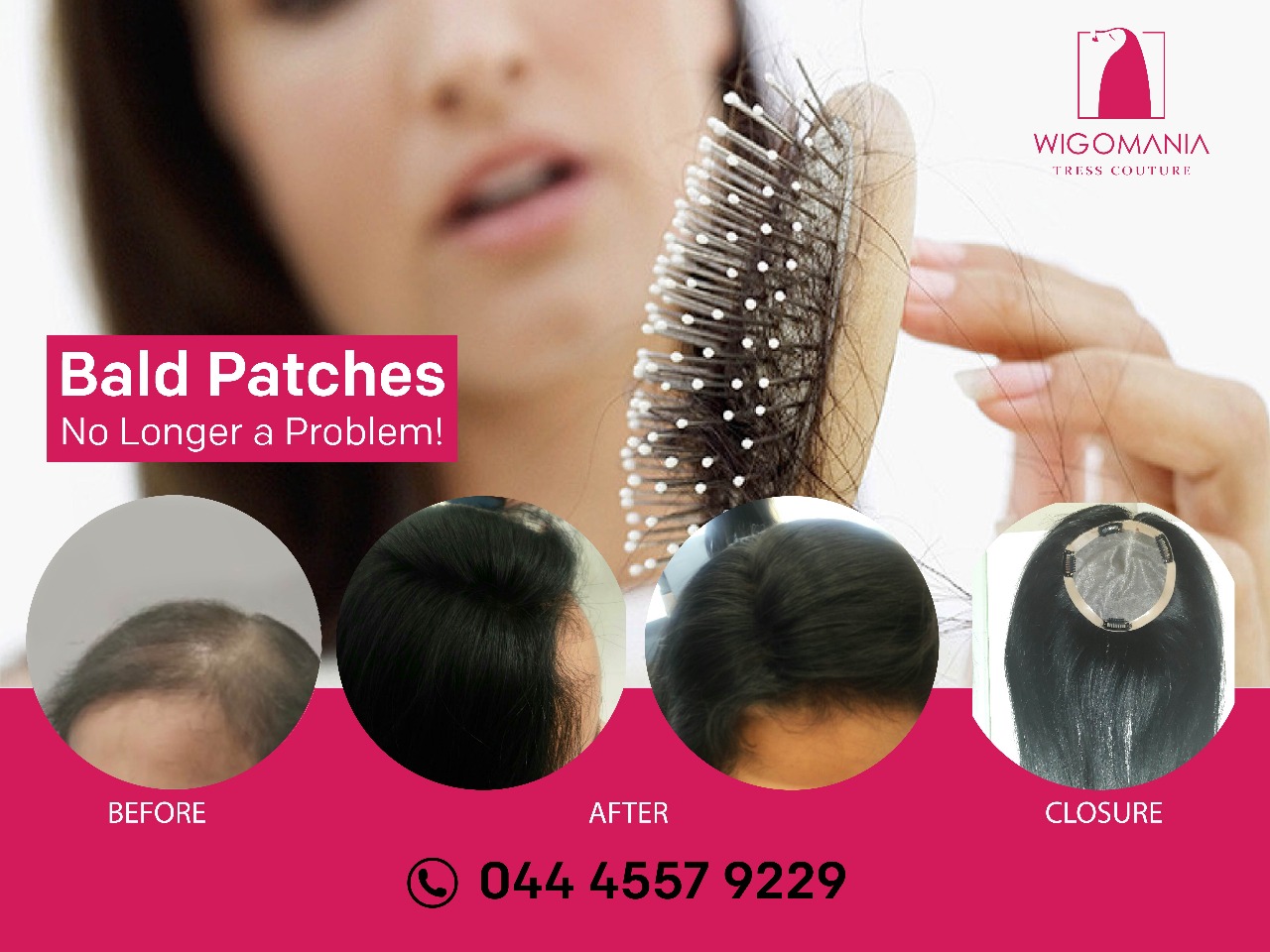 Hair Toppers for Women in Chennai & Hyderabad - Wig-O-Mania UK Hair Brand