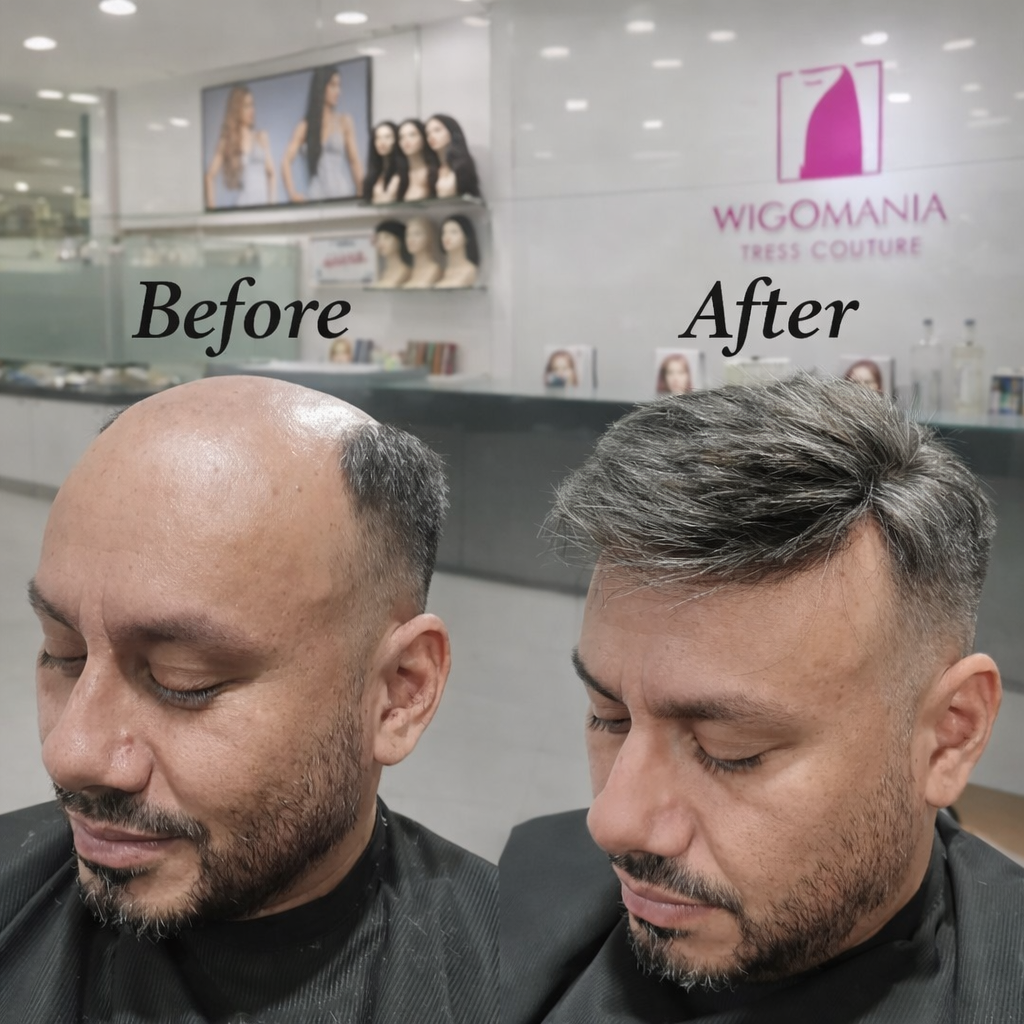 Real Wig Transformation Story from Wig-O-Mania Hyderabad