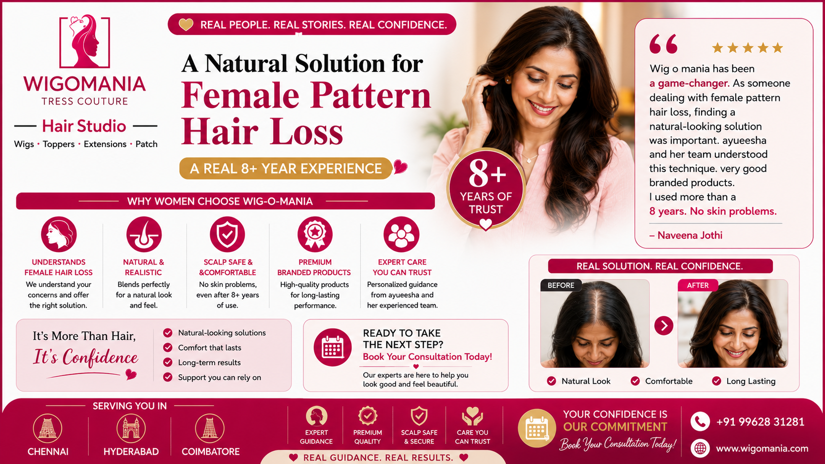 Female Pattern Hair Loss Solution in Chennai: A Real 8-Year Client Experience