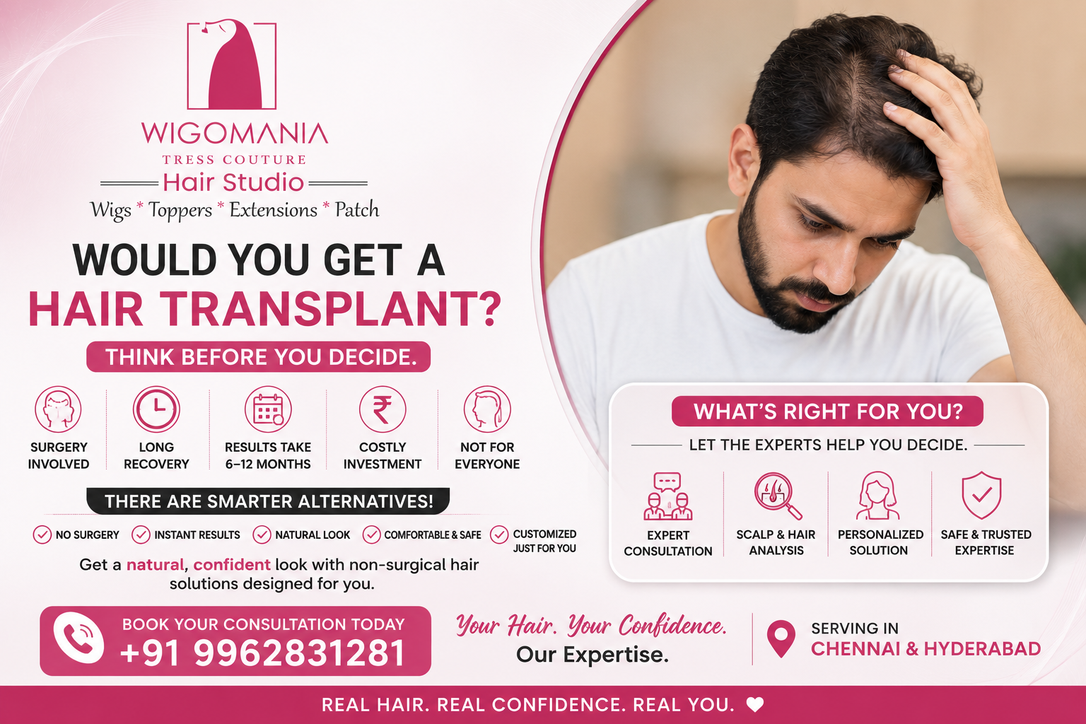 Would You Get a Hair Transplant? Things to Think About Before You Decide