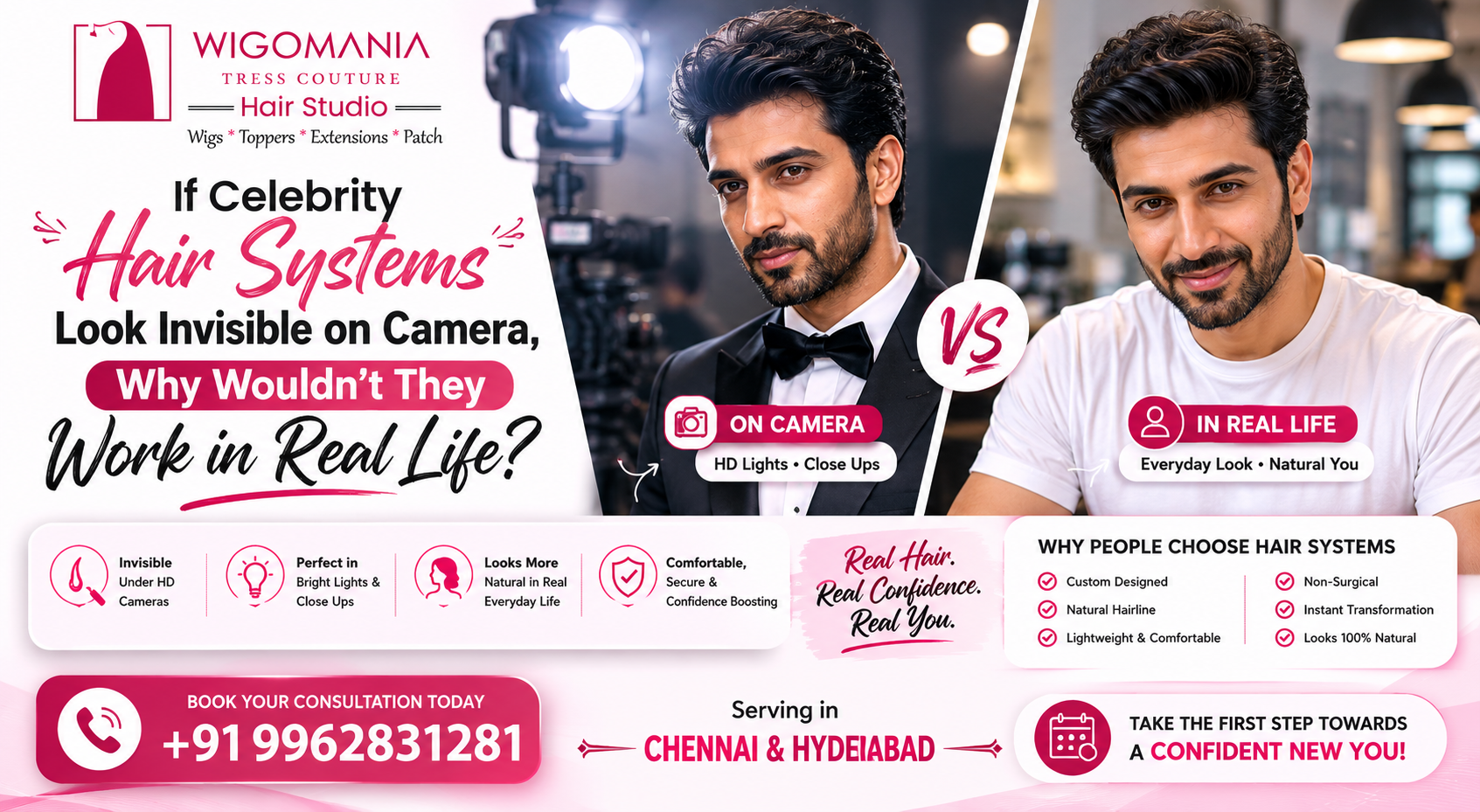 If Celebrity Hair Systems Look Invisible on Camera, Why Wouldn’t They Work in Real Life? | Chennai & Hyderabad