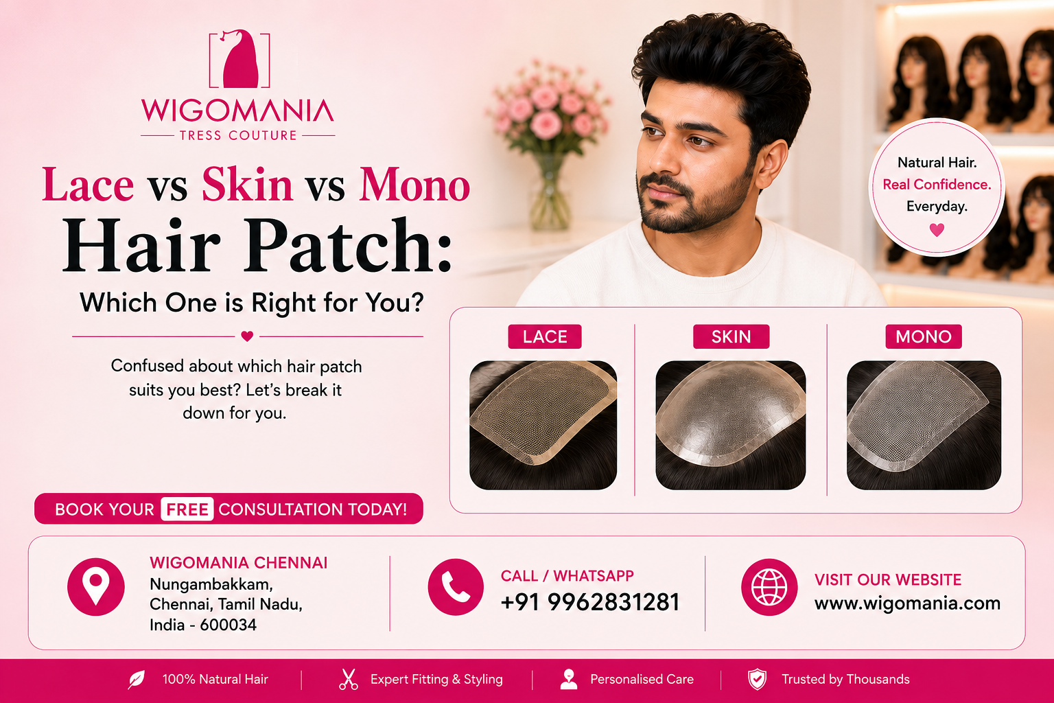 Lace vs Skin vs Mono Hair Patch: Which Is Best for Chennai Weather?