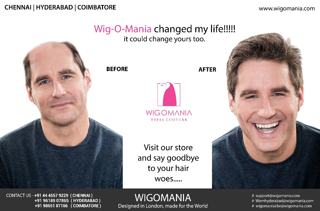 Non-Surgical Hair Replacement Explained: Patches, Weaving, Bonding & More