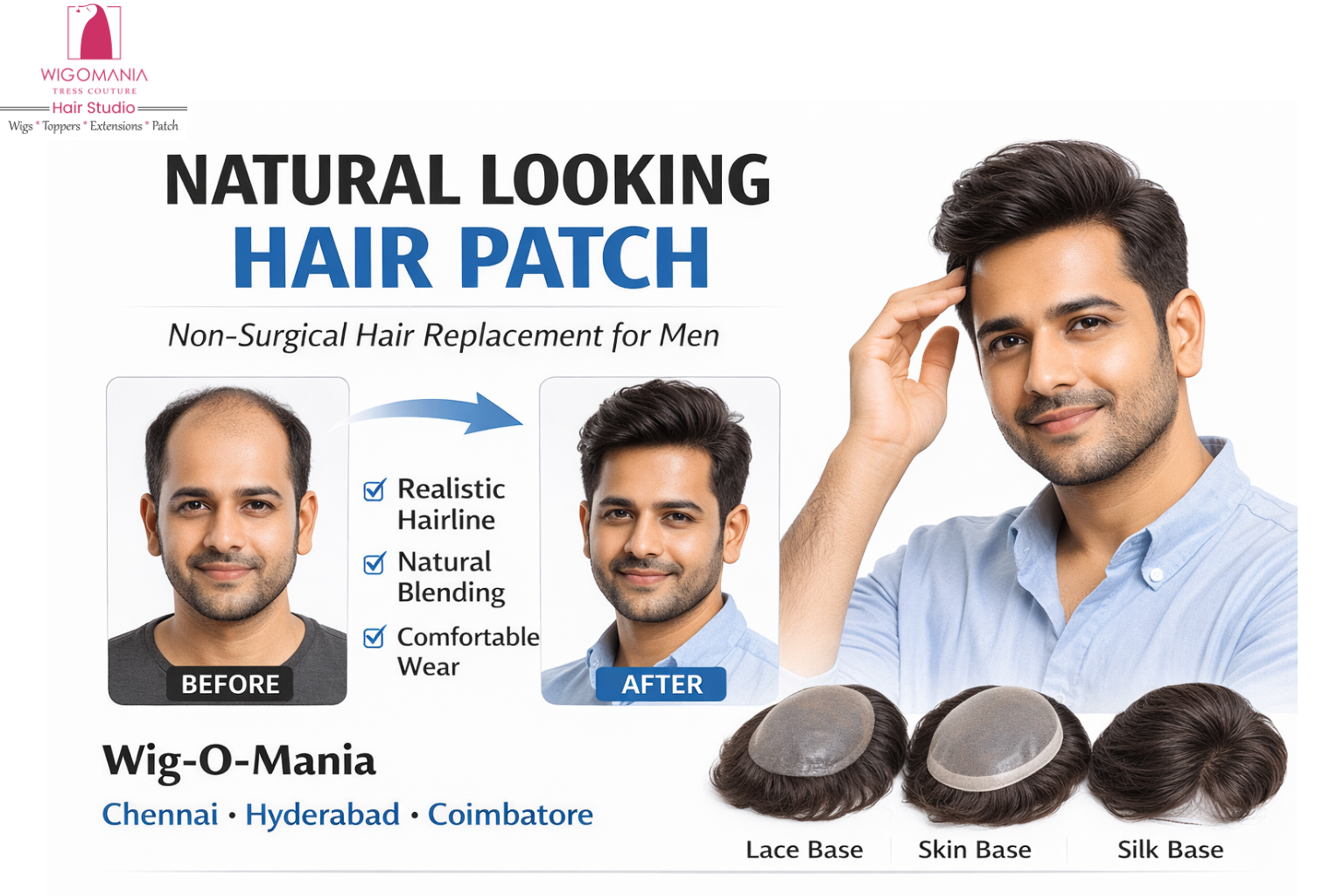 Natural Looking Hair Patch for Men: The Complete Guide in India (Chennai, Hyderabad & Coimbatore)