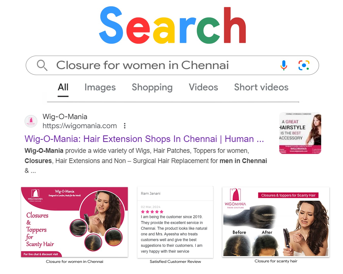 Range of toppers for Alopecia and scanty hair in Chennai & Hyderabad