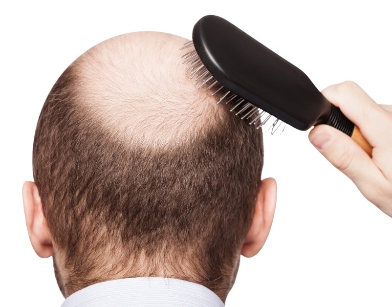 *Men's Hair Systems*