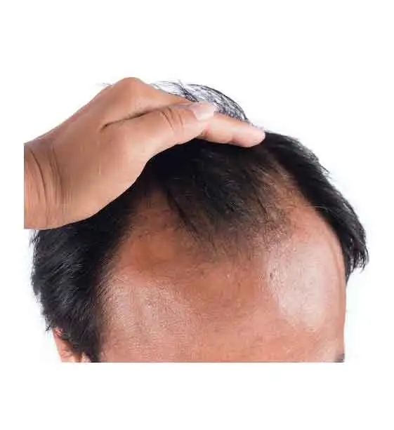 *Men's Hair Systems*